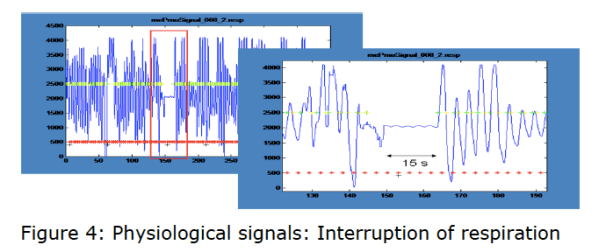 Screen Shot 2017-04-17 at 3.26.56 PM